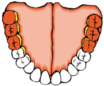 gomfioi